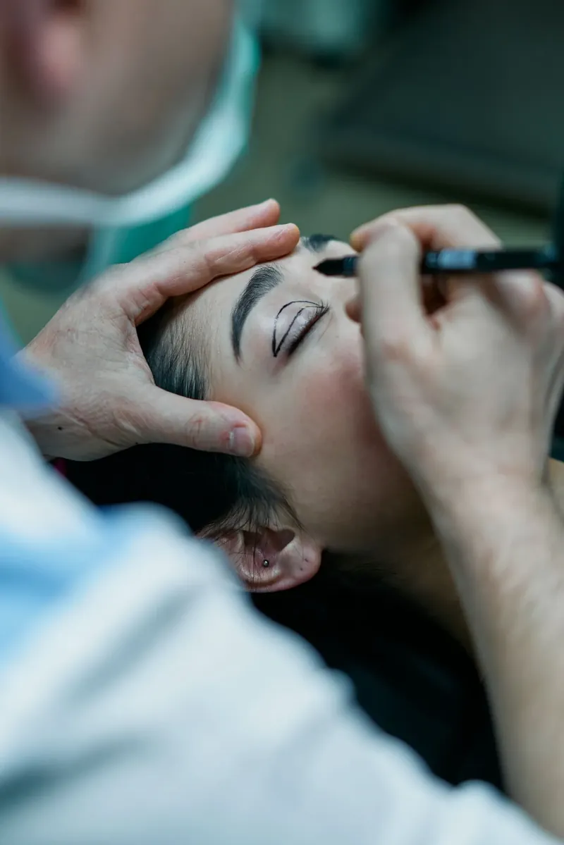 Planning moment where the surgeon takes precise measurements and markings before eyelid surgery
